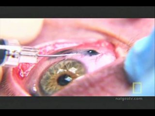 how to make a tattoo on the eyeball